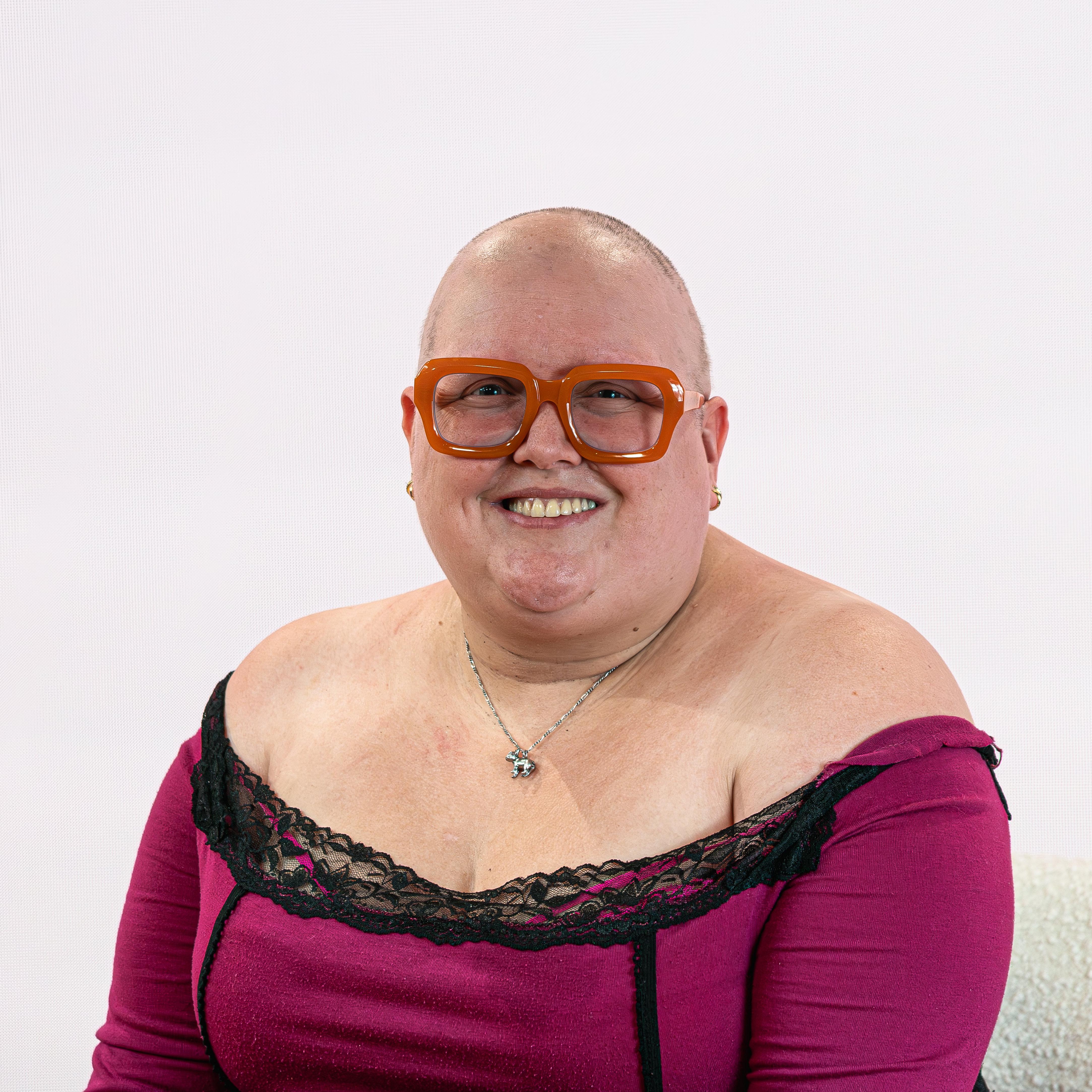 What is alopecia? | Boots