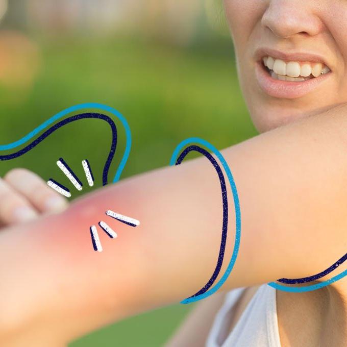 A person looking at an insect bite on their arm
