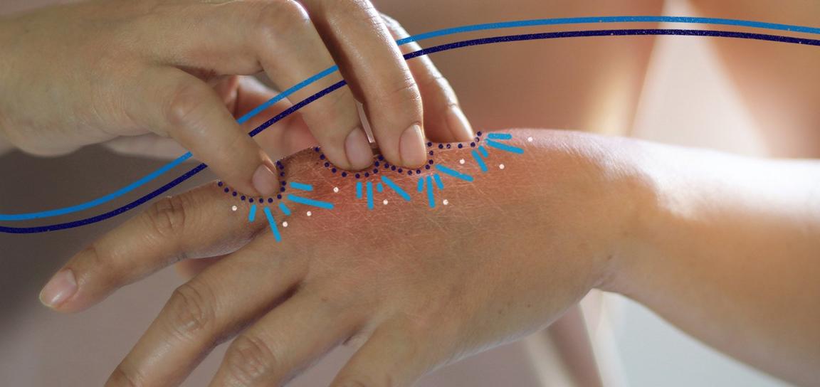 Someone scratching their hand