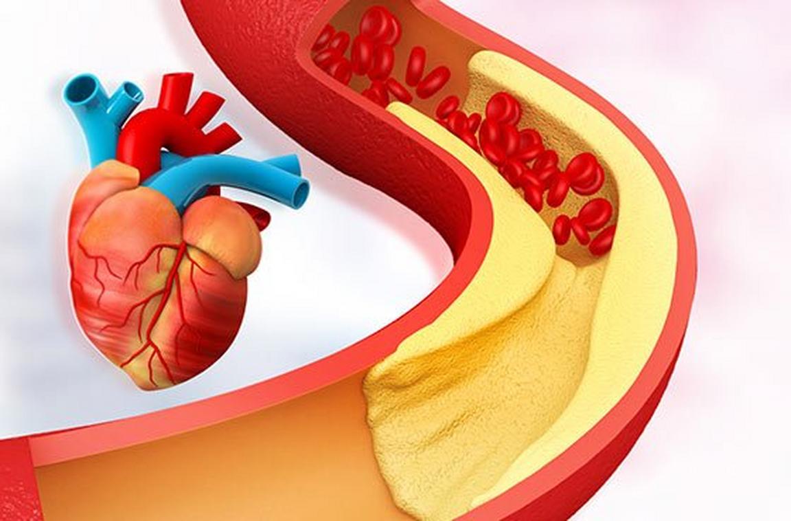 High Cholesterol: How to Manage & Prevent - Boots Health Hub