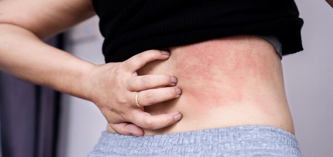 Skin Conditions Services & Advice - Boots Health Hub