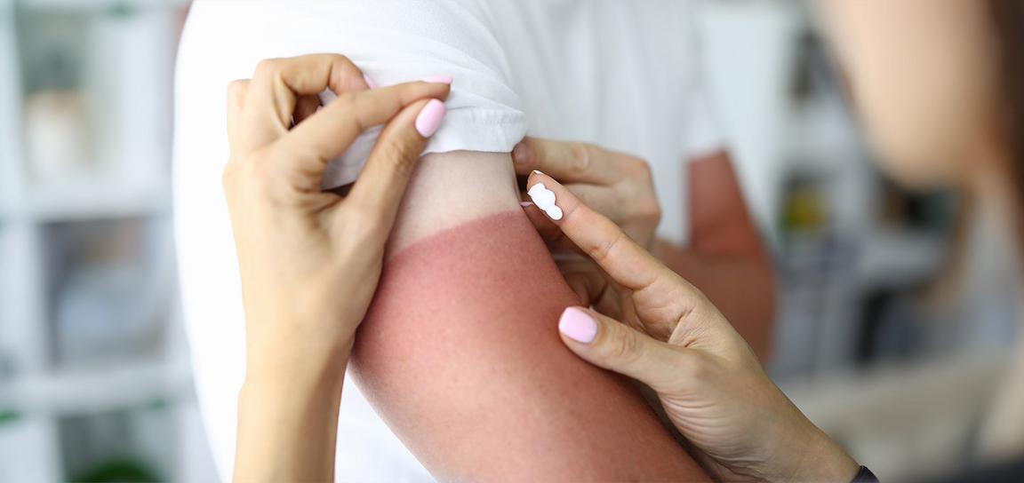 woman tends to a man's arm, carefully placing a cream on a minor injury.
