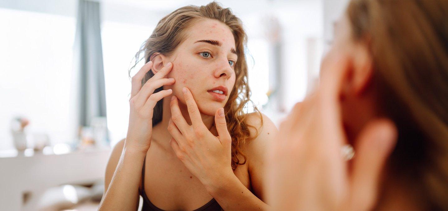 Person examining facial blemishes in a mirror while touching the cheek.