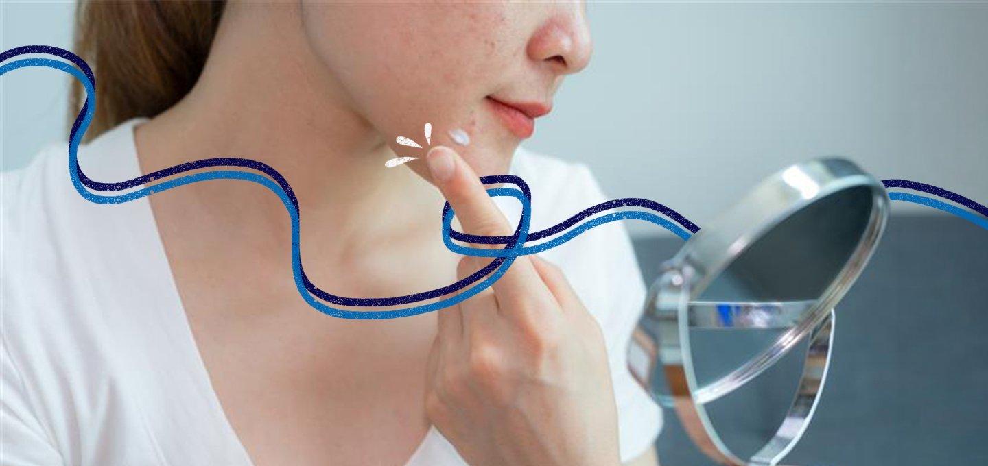 Person applying cream to a facial blemish while looking in a handheld mirror.